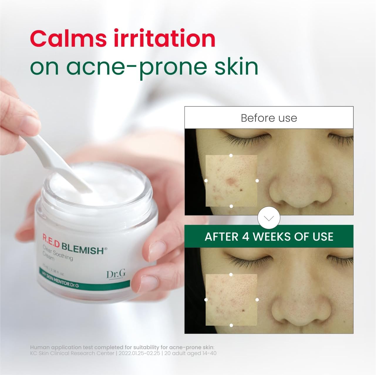 Dr.G R.E.D Blemish Soothing Cream (70ml)